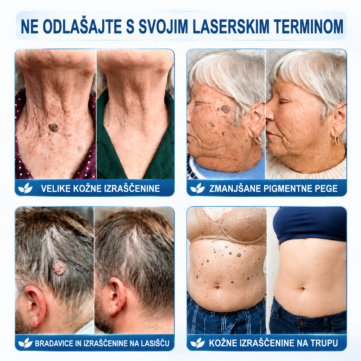 Uradna trgovina|💎𝐇𝐈𝐒𝐊𝐈𝐍®7 dnevni odstranjevalec kožnih izrastkov in madežev(𝐫𝐨𝐥𝐥-𝐨𝐧 𝐚𝐩𝐥𝐢𝐤𝐚𝐭𝐨𝐫: 𝐛𝐫𝐞𝐳 𝐛𝐨𝐥𝐞č𝐢𝐧 𝐢𝐧 𝐛𝐫𝐚𝐳𝐠𝐨𝐭𝐢𝐧)🌳