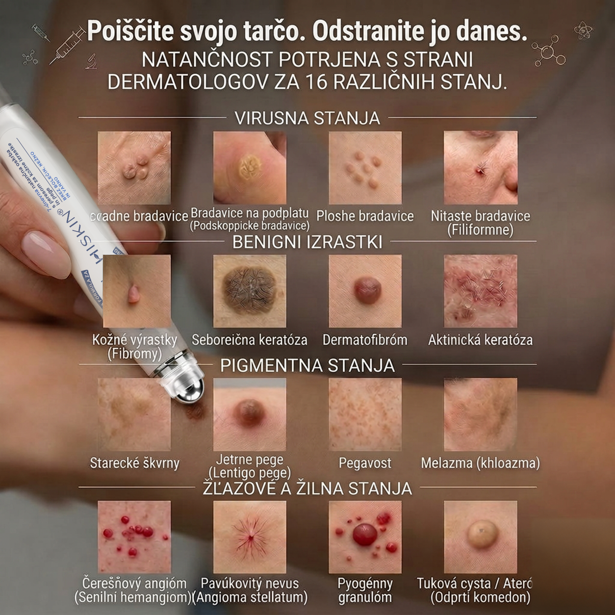 Uradna trgovina|💎𝐇𝐈𝐒𝐊𝐈𝐍®7 dnevni odstranjevalec kožnih izrastkov in madežev(𝐫𝐨𝐥𝐥-𝐨𝐧 𝐚𝐩𝐥𝐢𝐤𝐚𝐭𝐨𝐫: 𝐛𝐫𝐞𝐳 𝐛𝐨𝐥𝐞č𝐢𝐧 𝐢𝐧 𝐛𝐫𝐚𝐳𝐠𝐨𝐭𝐢𝐧)🌳